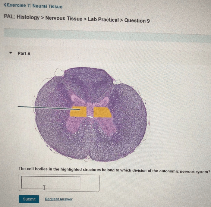 Exercise 15 histology of nervous tissue