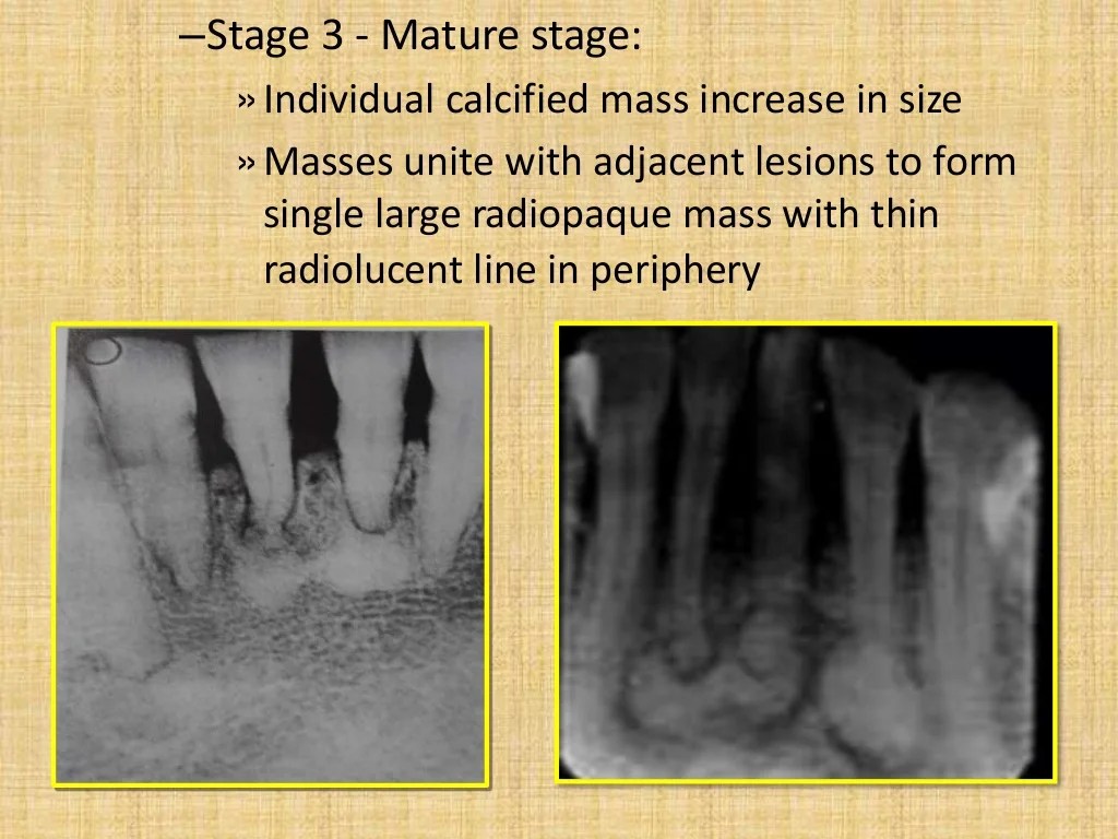 Radiopaque jaw radiolucent lesions diagnosis differential