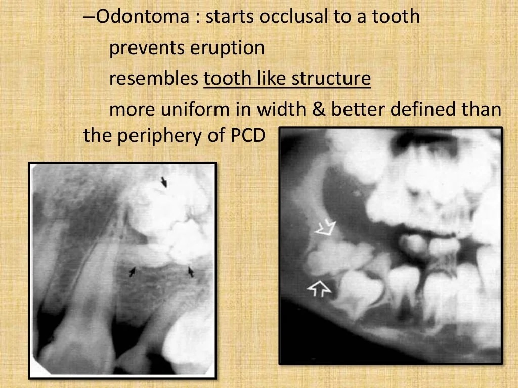 Lesions radiopaque jaw differential