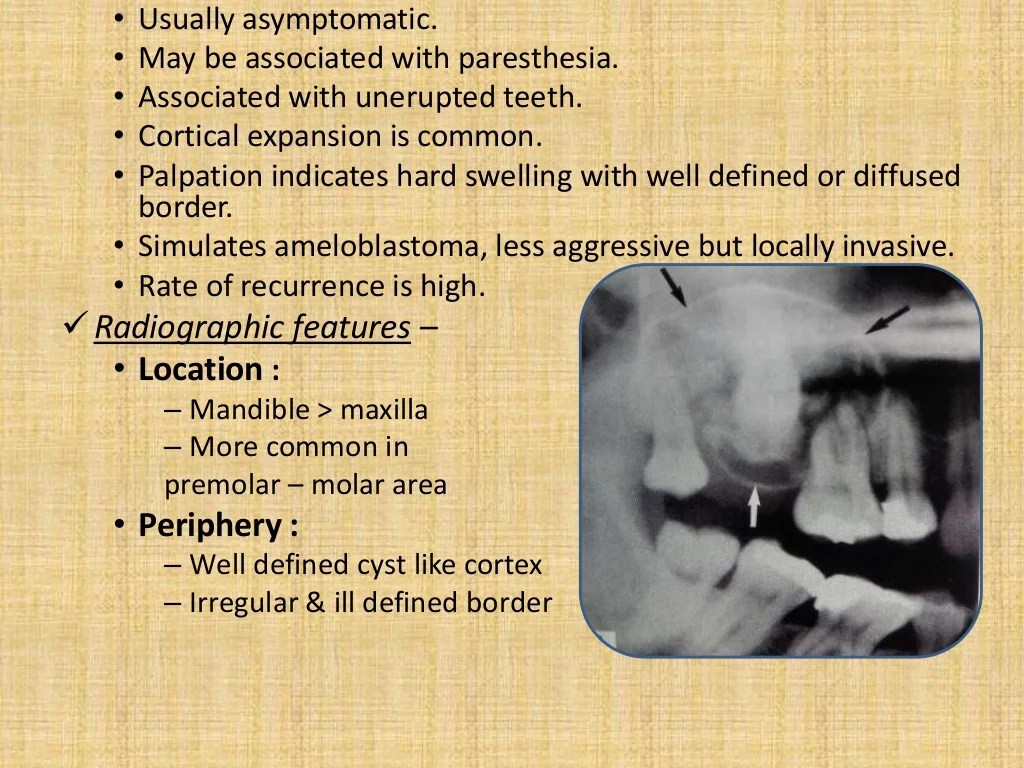 Radiopaque lesions of the mandible