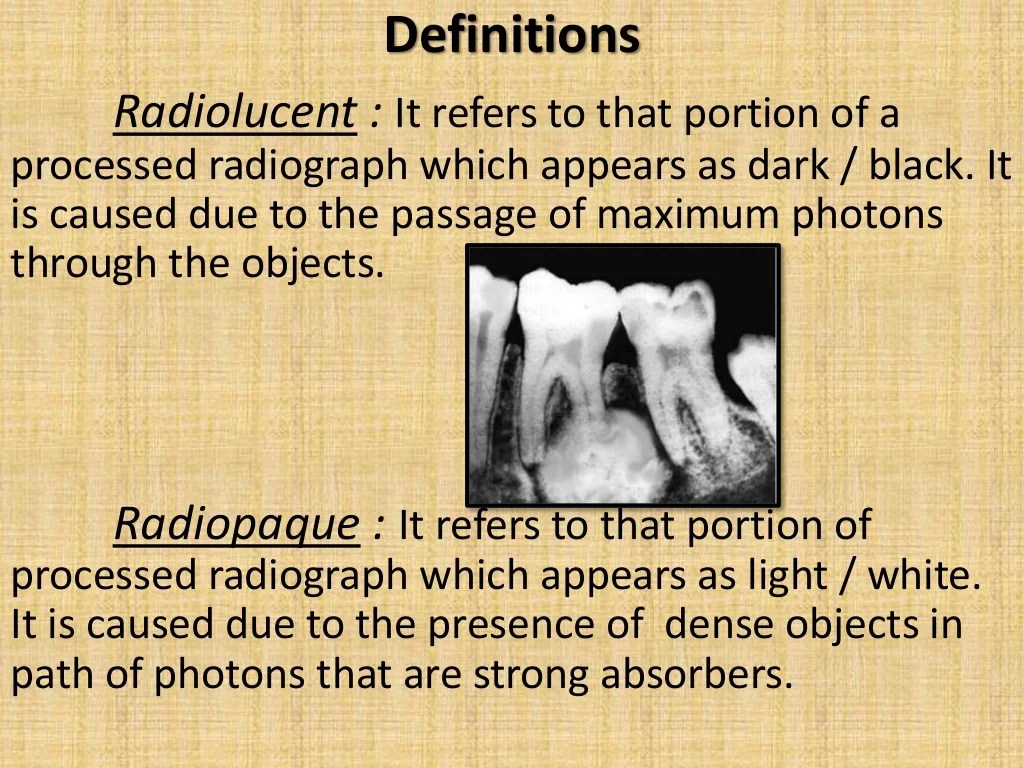 Radiopaque lesions of the mandible