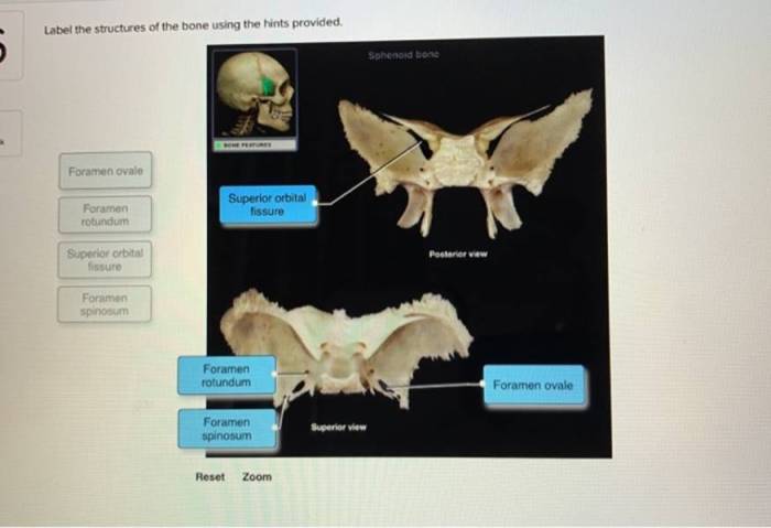 Label the female perineum using the hints provided.