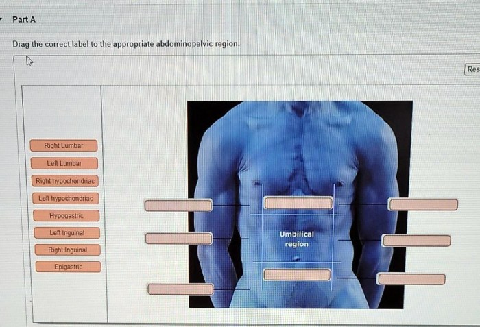 Drag the correct label to the appropriate abdominopelvic region