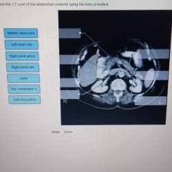 Label the female perineum using the hints provided.