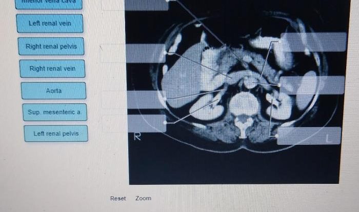 Label the female perineum using the hints provided.