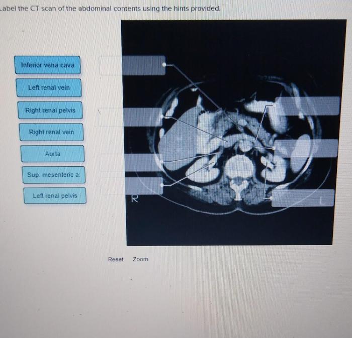 Label the female perineum using the hints provided.